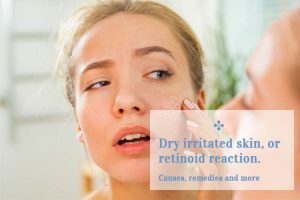 retinoid reaction